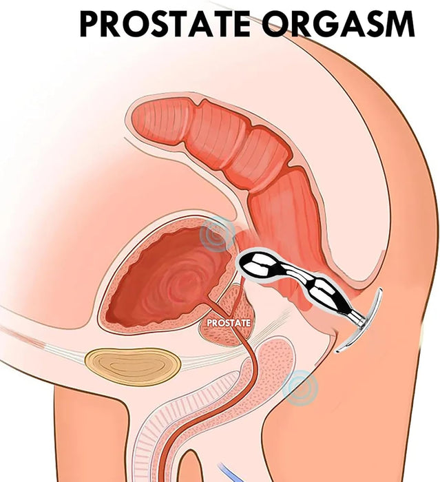 Аналплаг из нержавеющей стали с T-образной ручкой с сильной присоской для стимуляции